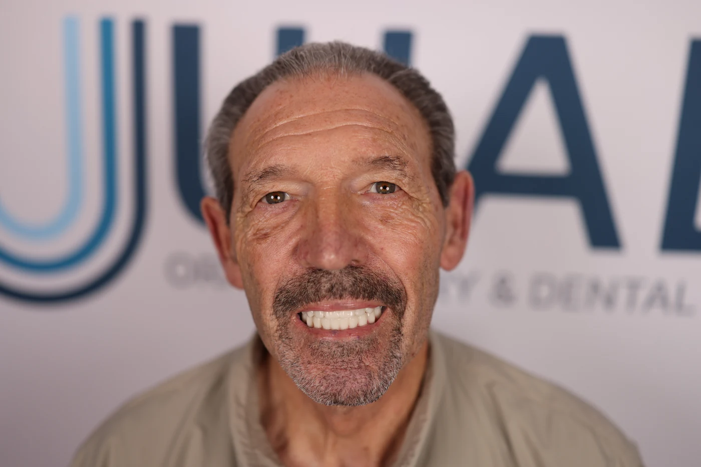Patient smile after full-arch dental implant treatment, patient case 02