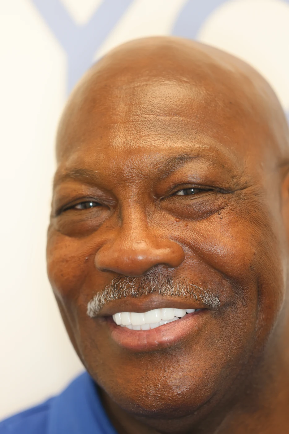 Patient smile after full-arch dental implant treatment, patient case 04