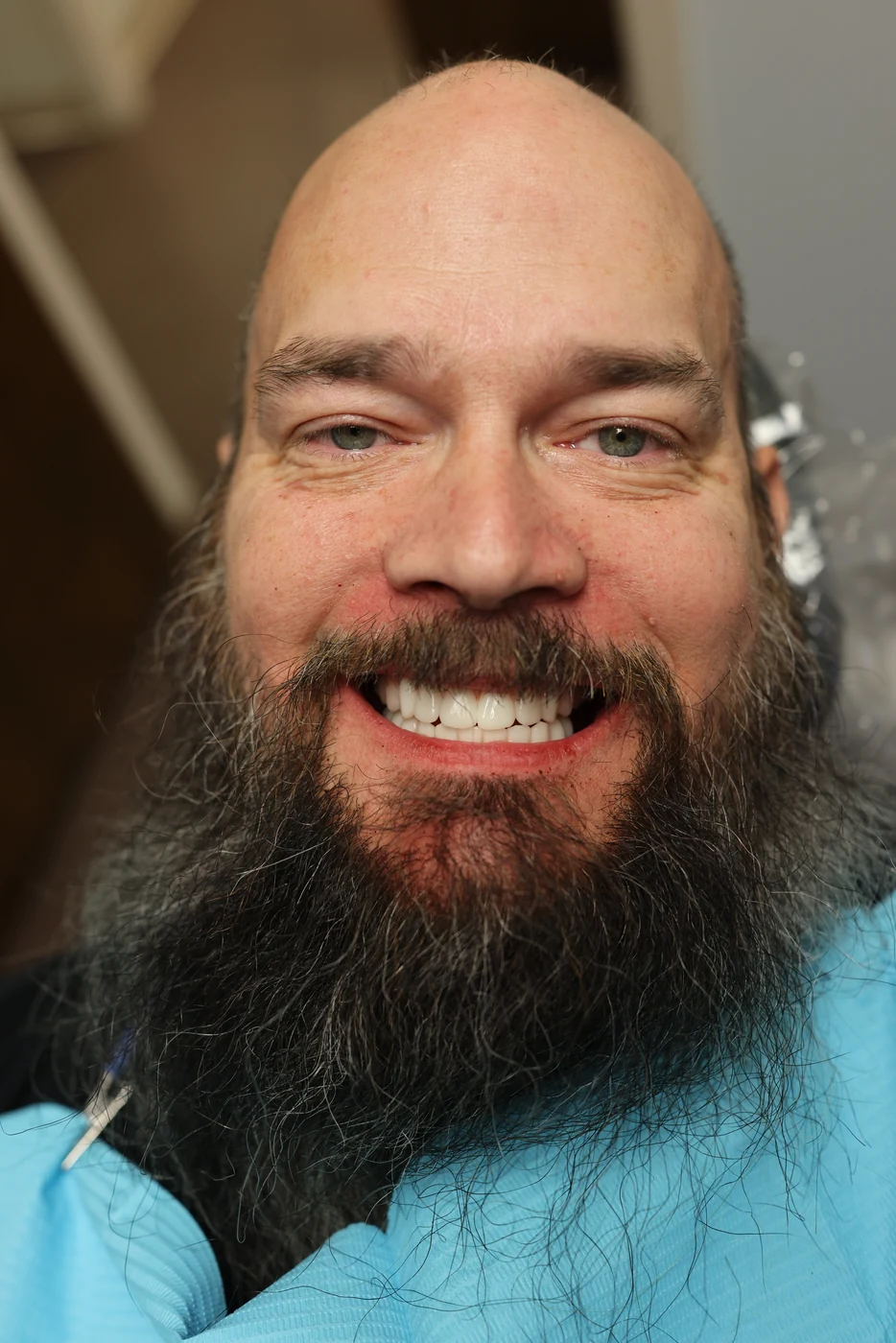 Patient smile after full-arch dental implant treatment, patient case 05
