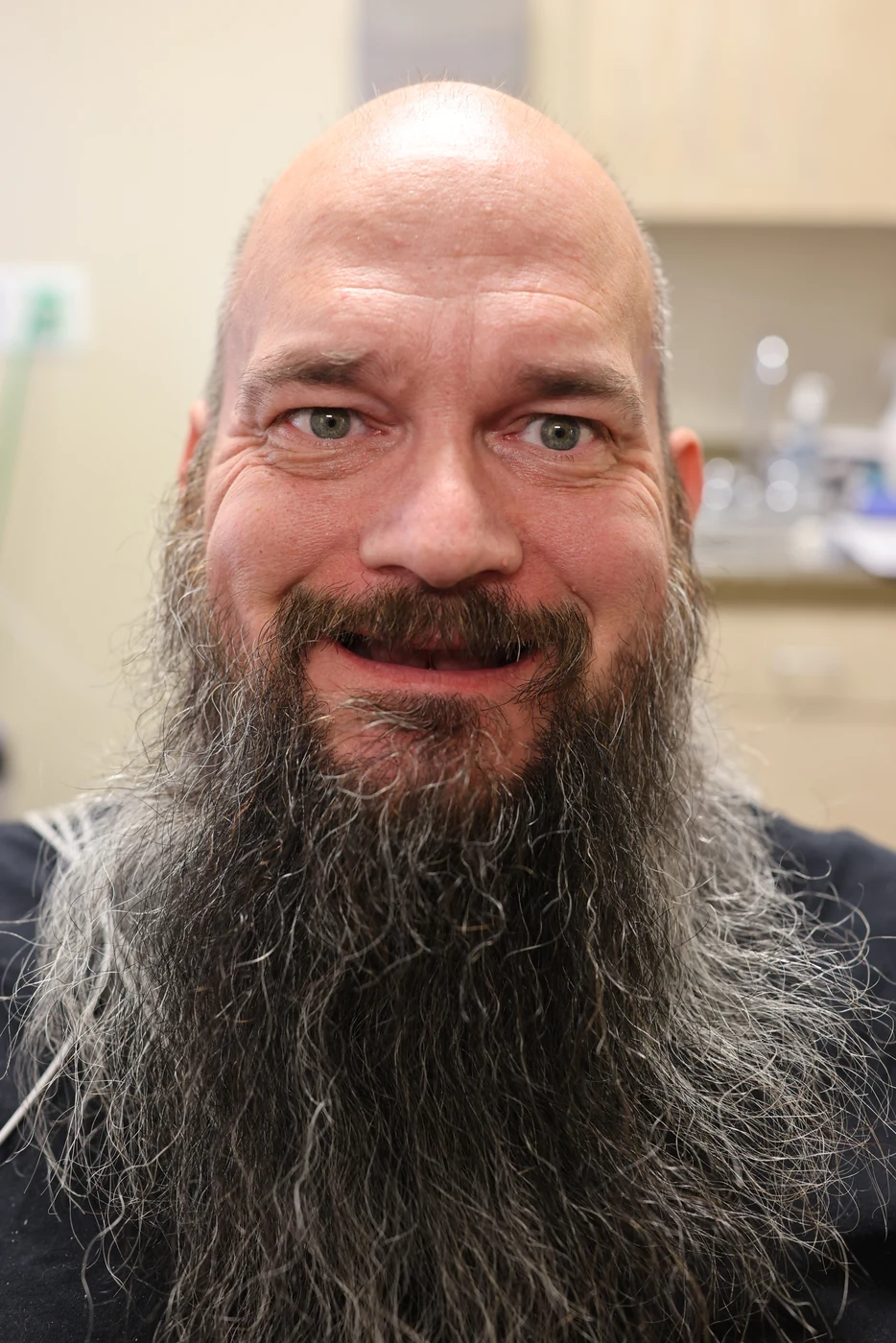 Before full-arch dental implant treatment, patient case 05
